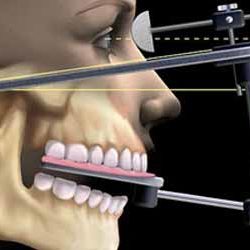 disfunzionali disfunzionali